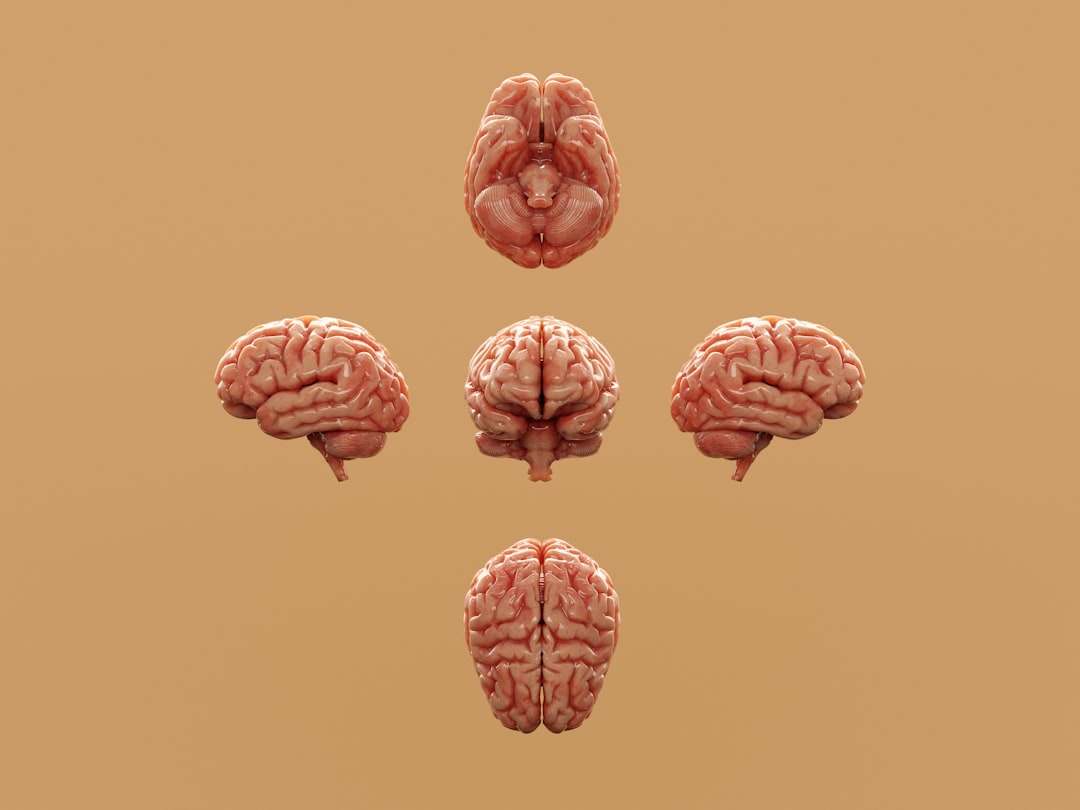 Advancing Alzheimer’s Prediction: TabPFN Outshines Traditional Models in Data Scarcity